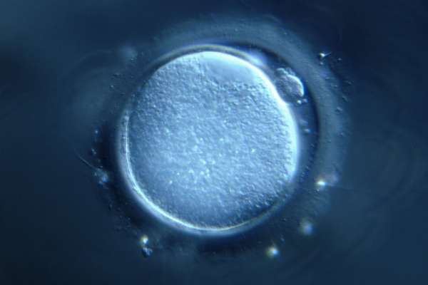 Women Egg Cell